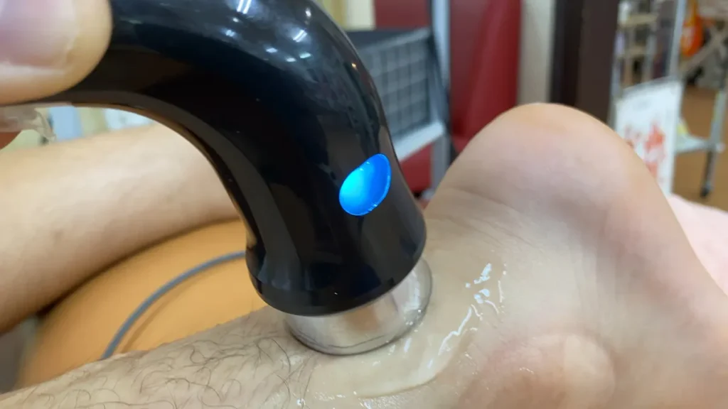 アキレス腱炎の治療