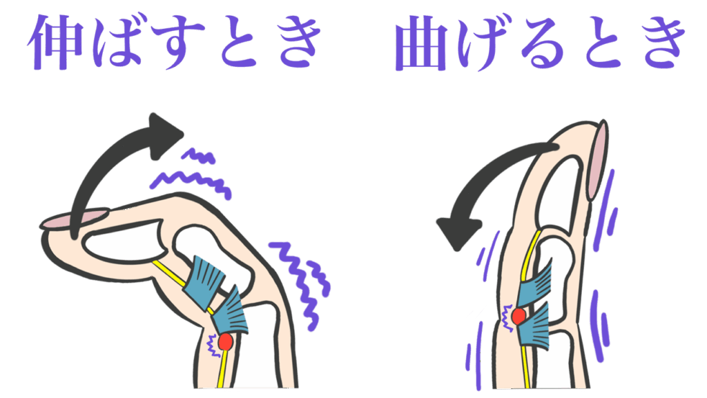 大田区ばね指専門