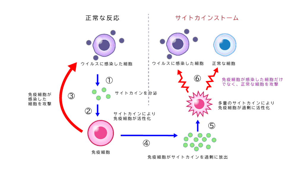 コロナ後遺症のサイトカインストーム