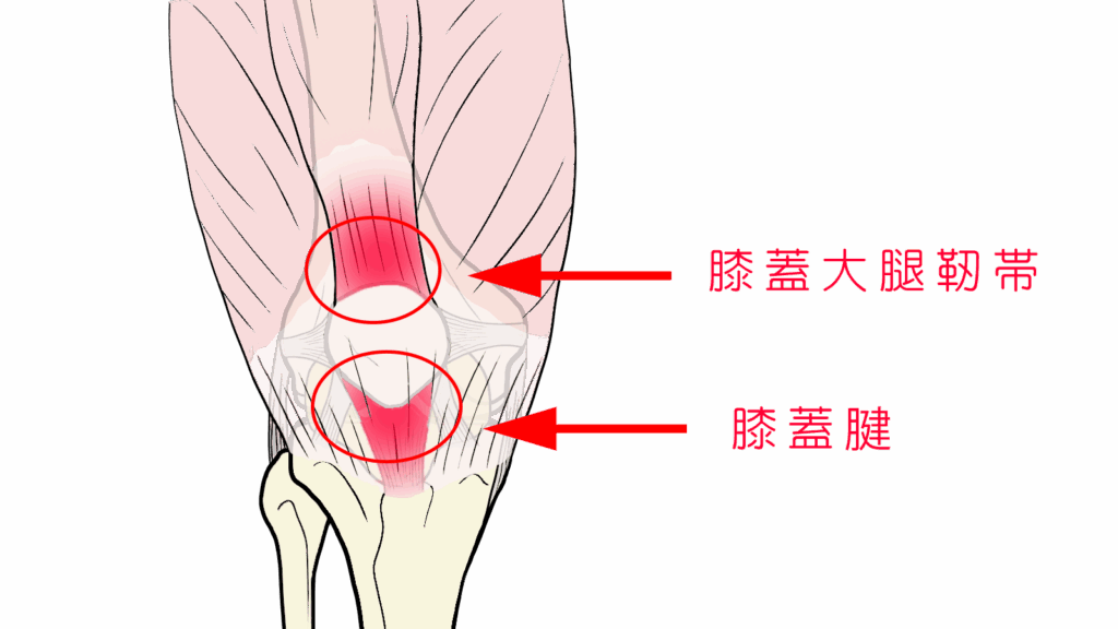 ジャンパー膝の原因