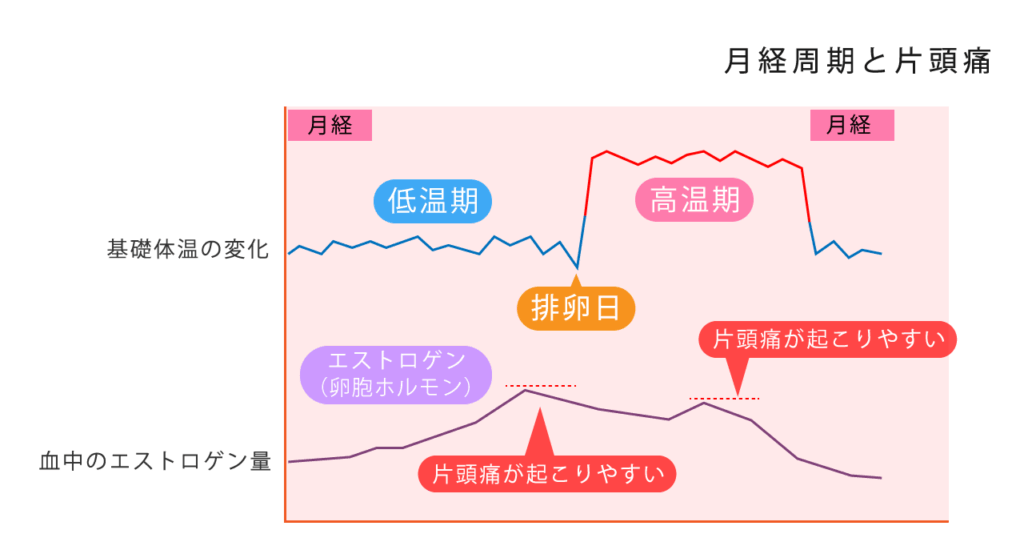 生理痛と片頭痛