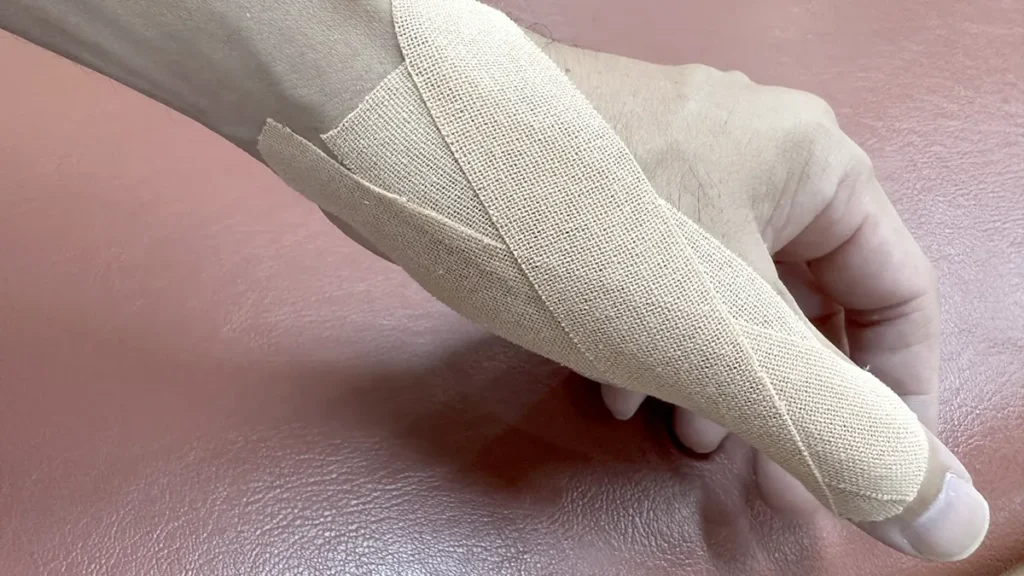 腱鞘炎のテーピング